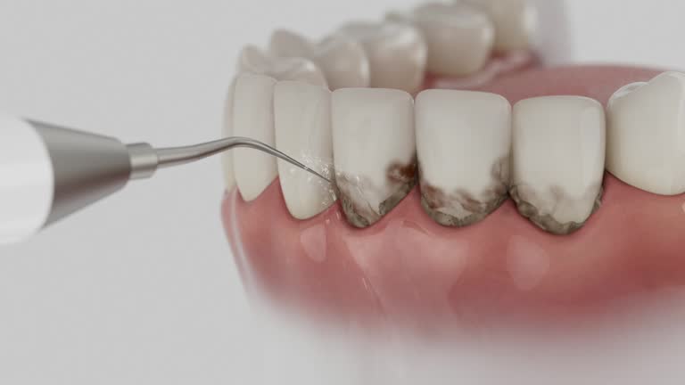 Trusted Teeth Whitening service in Marietta, OK - Dentist Open Now